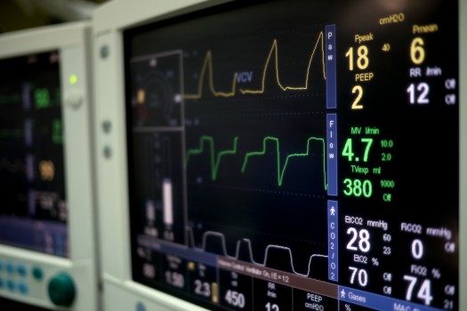 Heart monitor in hospital ER